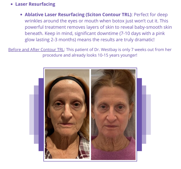 Laser Resurfacing